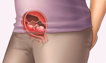 dolore pelvico retro e vagina