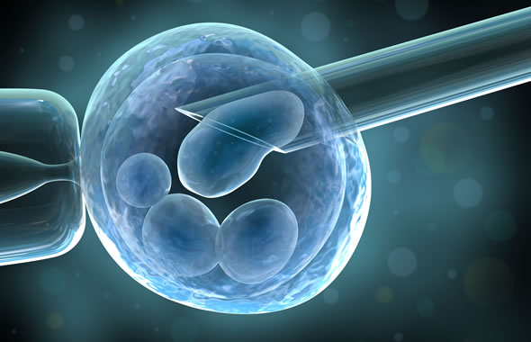 impianto di cellule staminali