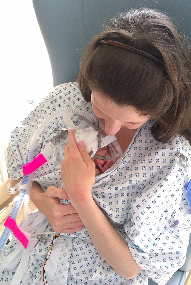 Eloise Nasce In Bagno A 23 Settimane E Non Si Arrende Alle Avversita Foto