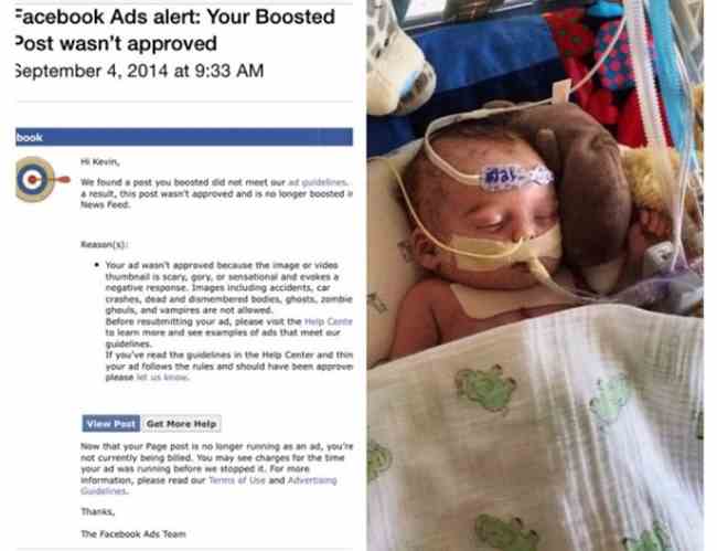 facebook censura la foto del bambino in ospedale
